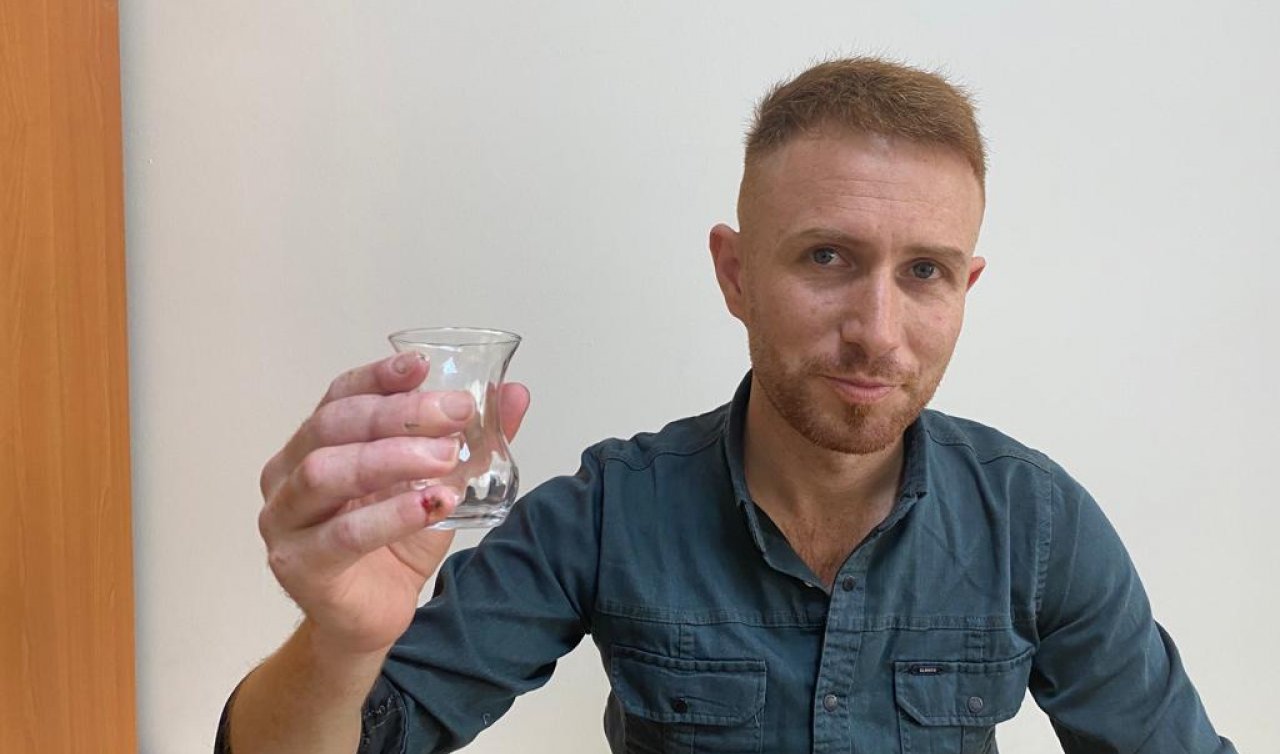 Konya’da şaşırtan olay! Dört parmağı koptu 16 saat sonra dikildi