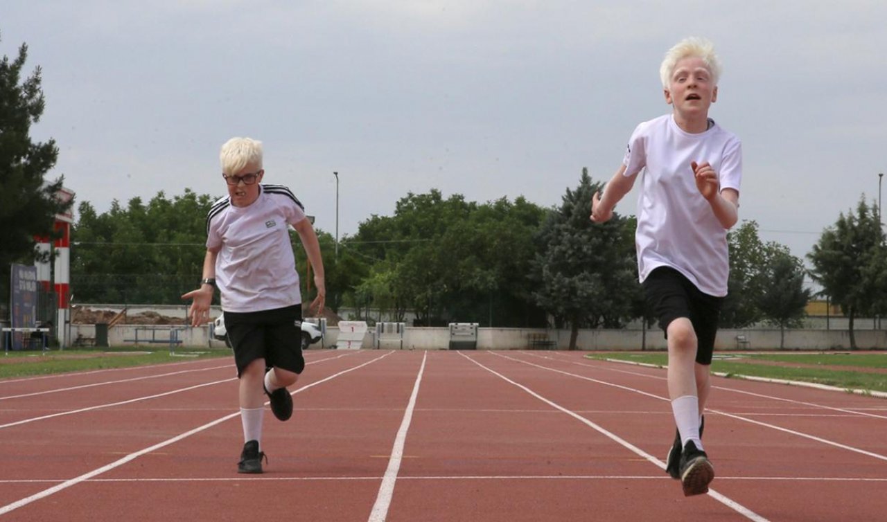 Şampiyon albino çocuklar atletizmde uluslararası başarılara odaklandı