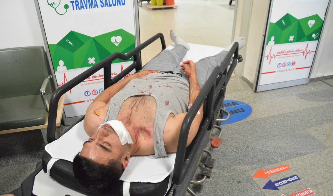 Otobüste darbedip palayla yaraladı! Sebebini duyanlar şok oldu!