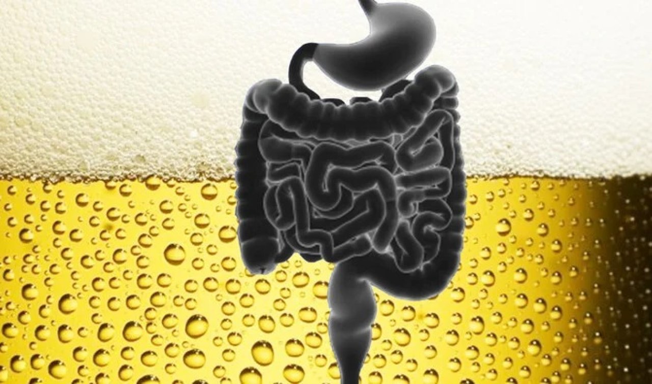 Vücudu alkol üreten insanlar: Auto-Brewery Sendromu Türkiye’de görüldü!