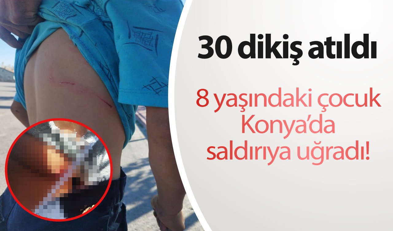  8 yaşındaki çocuk Konya’da saldırıya uğradı! 30 dikiş atıldı