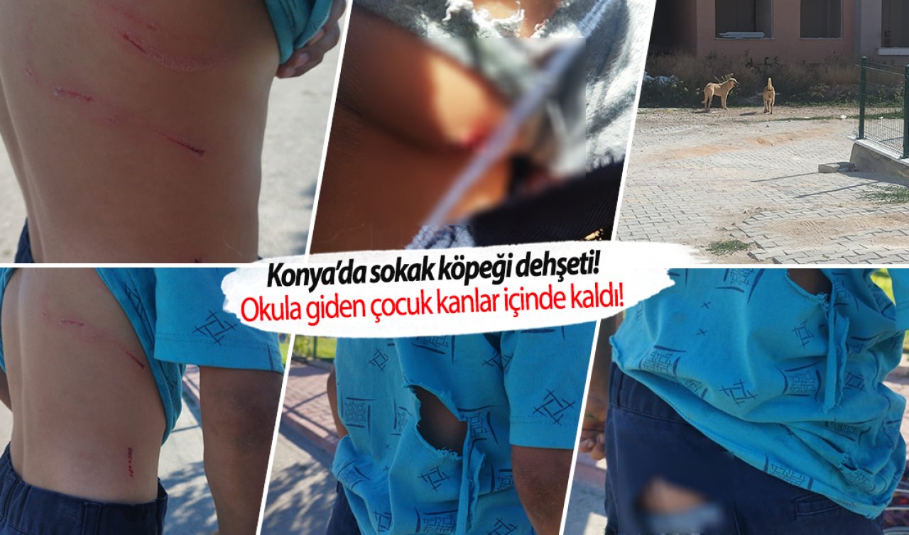 Konya’da sokak köpeği dehşeti! Okula giden çocuk kanlar içinde kaldı