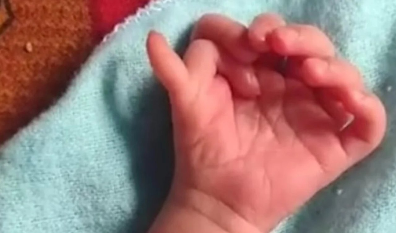 Şaşkına çeviren olay! 26 parmağı olan bebek dünyaya geldi