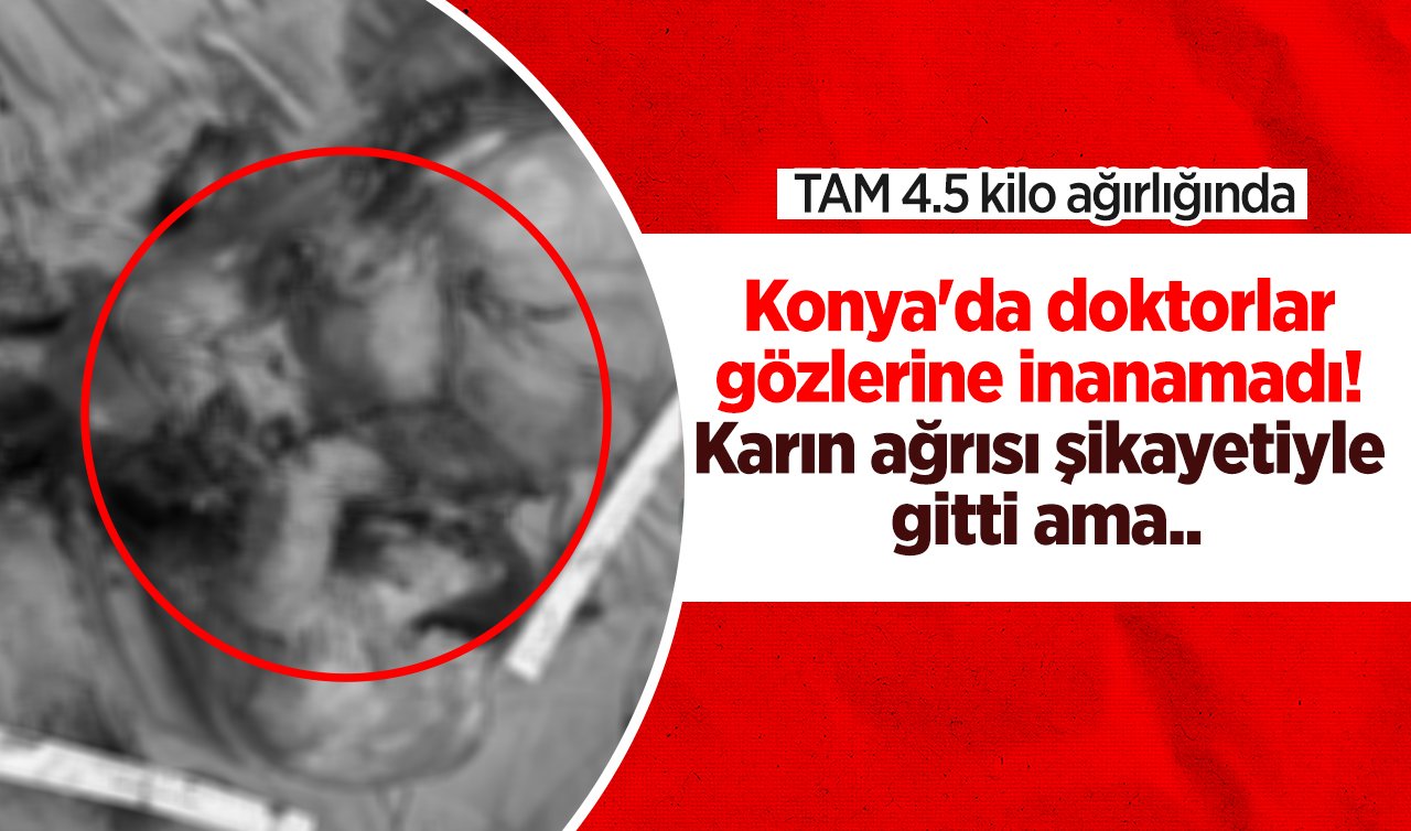 Konya’da doktorlar gözlerine inanamadı! 25 cm büyüklüğünde, 4.5 kilo ağırlığında.. 