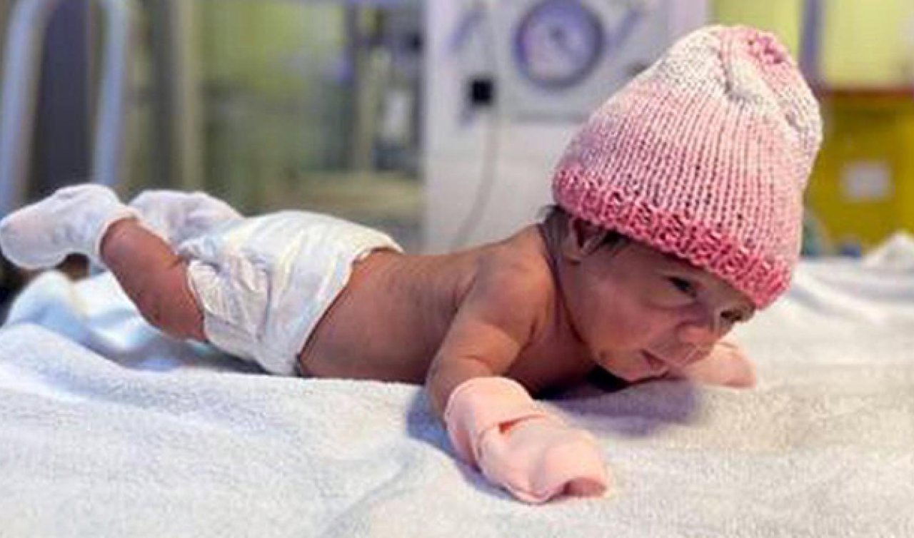 515 gram doğan bebek 98 günlük tedavisiyle sağlığına kavuştu