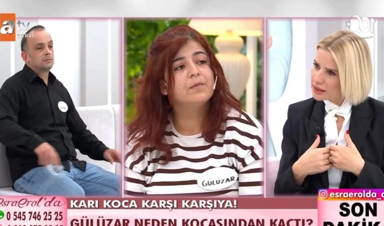 Esra Erol’da herkesi şok edecek o gelişme! Saçım yok diye beni beğenmiyor