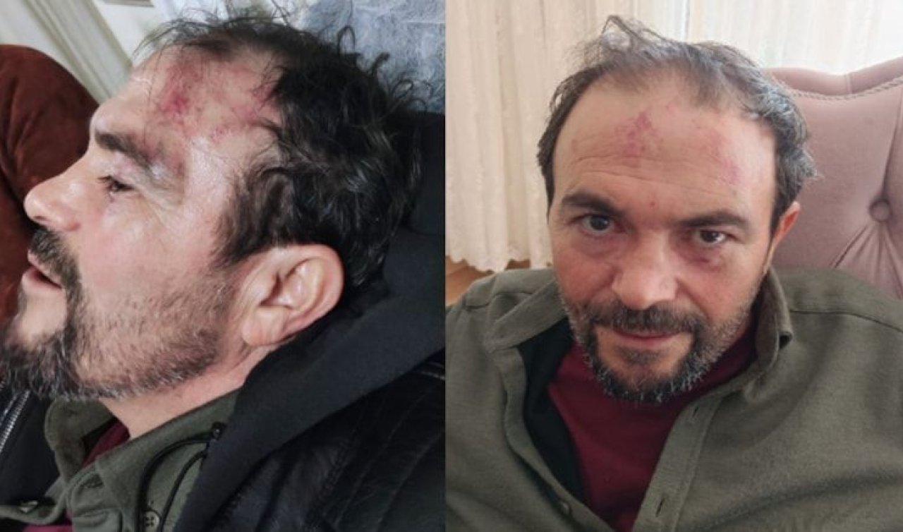  Öğrencileri şaka yapıyor sanıp polise kimlik göstermedi! darbedildiği iddiasıyla şikayetçi oldu