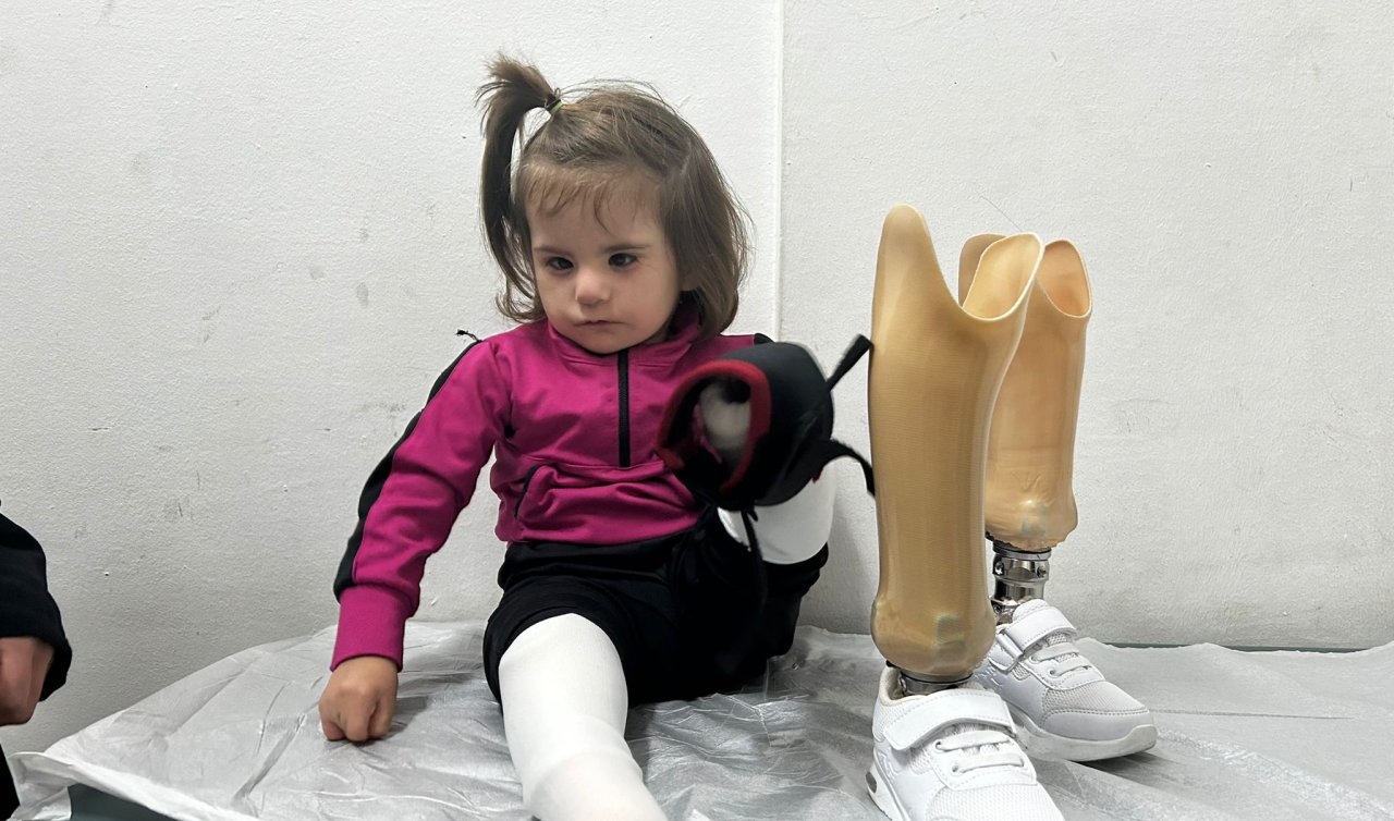 3,5 yaşındaki Tali protez bacaklarına kavuştu! 