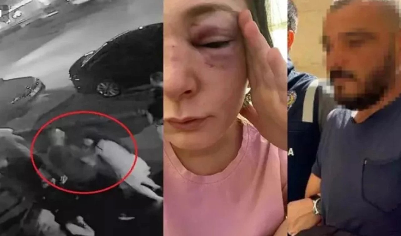 Dehşeti yaşattı: Eski sevgilisi vücudunda sigara söndürdü