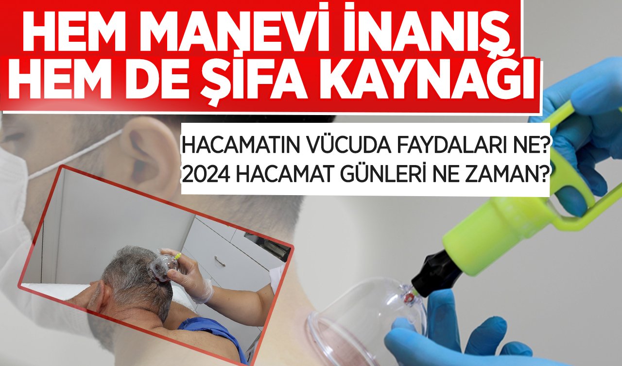 Hem manevi inanış hem de şifa kaynağı! Hacamatın vücuda faydaları ne, 2024 hacamat günleri ne zaman?