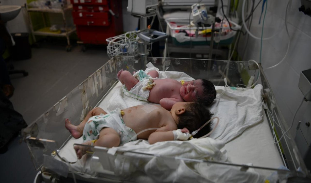 Gazze’de açlık nedeniyle sütü kesilen anneler bebeklerini besleyemiyor