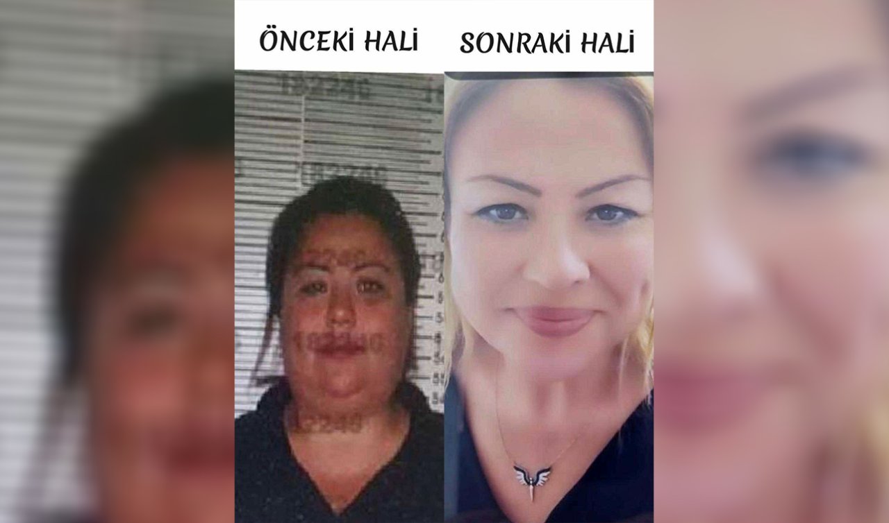 Kimliğini kullandığı kardeşine benzemek için estetik yaptırdı! Eski halinden eser kalmadı