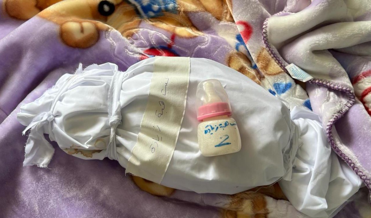 İsrail’in silah olarak kullandığı “açlık’’ Gazze’de 16 çocuğu öldürdü