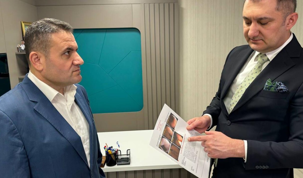 Obezite tedavisi için hastaneye gitti! Meğer mide kanseriymiş