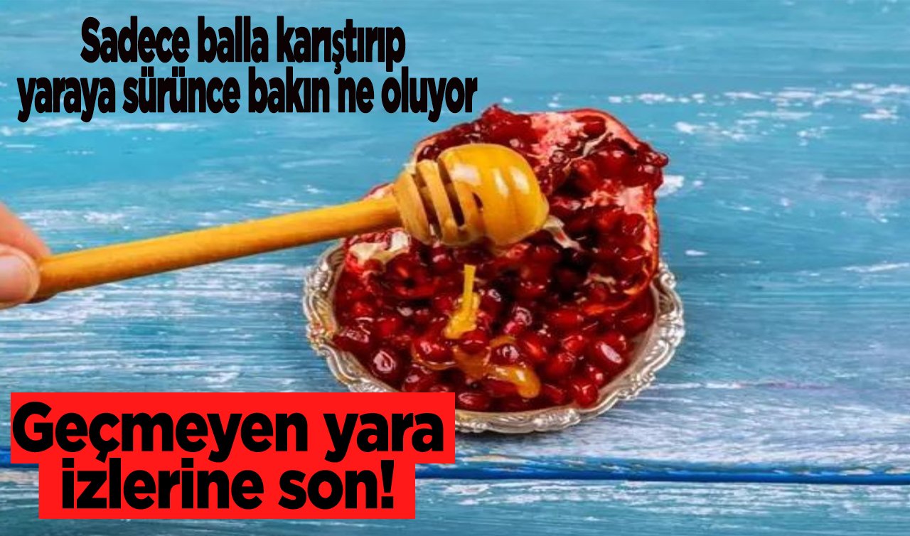  Geçmeyen yara izlerine son! Sadece balla karıştırıp yaraya sürünce bakın ne oluyor