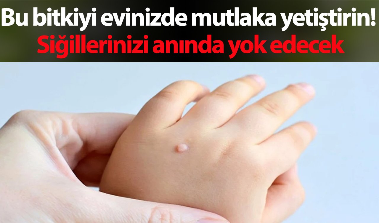 Bu bitkiyi evinizde mutlaka yetiştirin! Siğillerinizi anında yok edecek