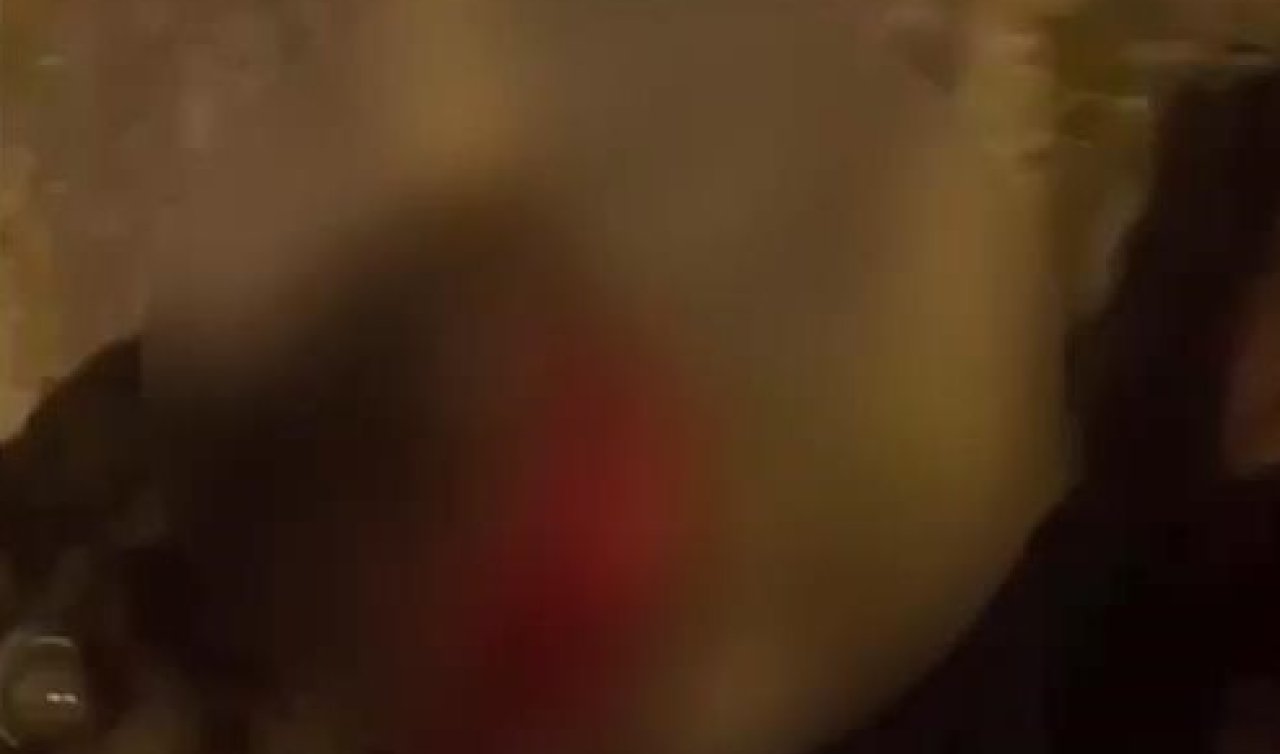 Bekçilerle şüpheliler arasında arbede; Bekçilerin ateş ettiği köpek yaralandı