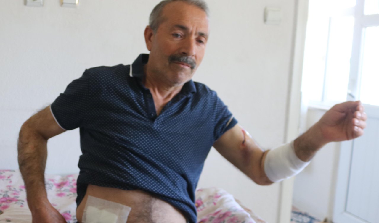  Sokak köpeklerinin saldırısında yaralandı