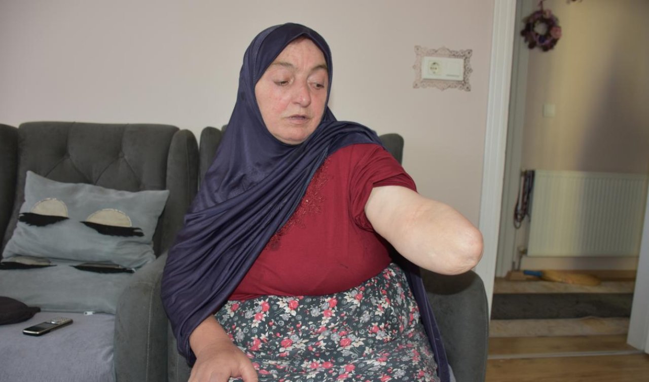  Köpeklerin saldırısından sonra kolunu kaybetti