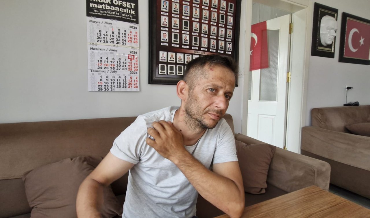  Taksiciyi dövüp, 2 bin 900 lirasını gasbettiler