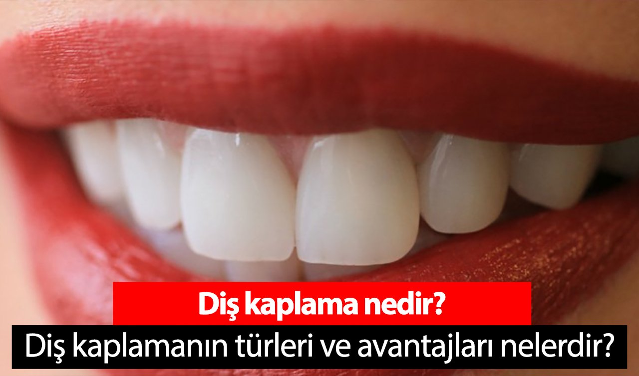 Diş kaplama nedir? Diş kaplamanın türleri ve avantajları nelerdir?