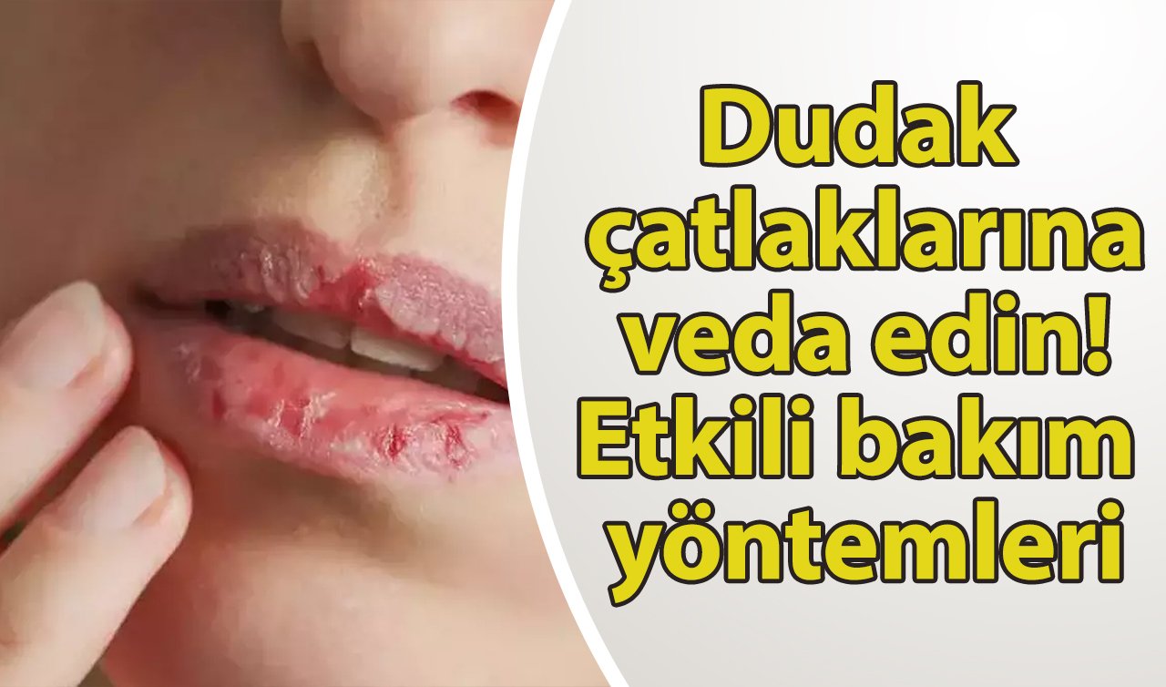  Dudak çatlaklarına ne iyi gelir? Dudak çatlakları için evde hazırlanabilecek karışımlar