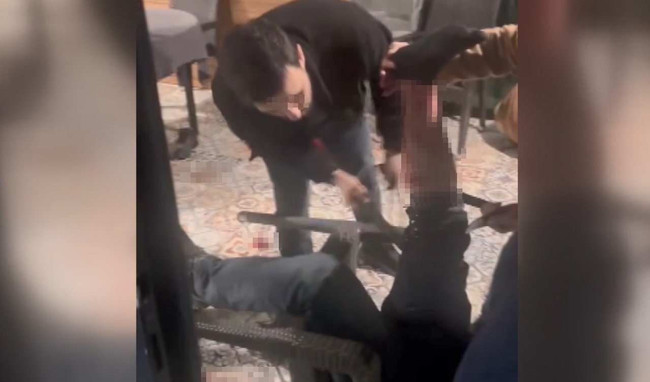  Adres sordu “bilmiyorum’’ cevabını alınca bacağından vurdu