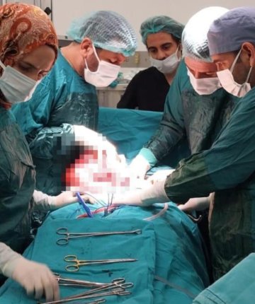 Bir kadının karnından 35 santimetrelik kitle çıkarıldı