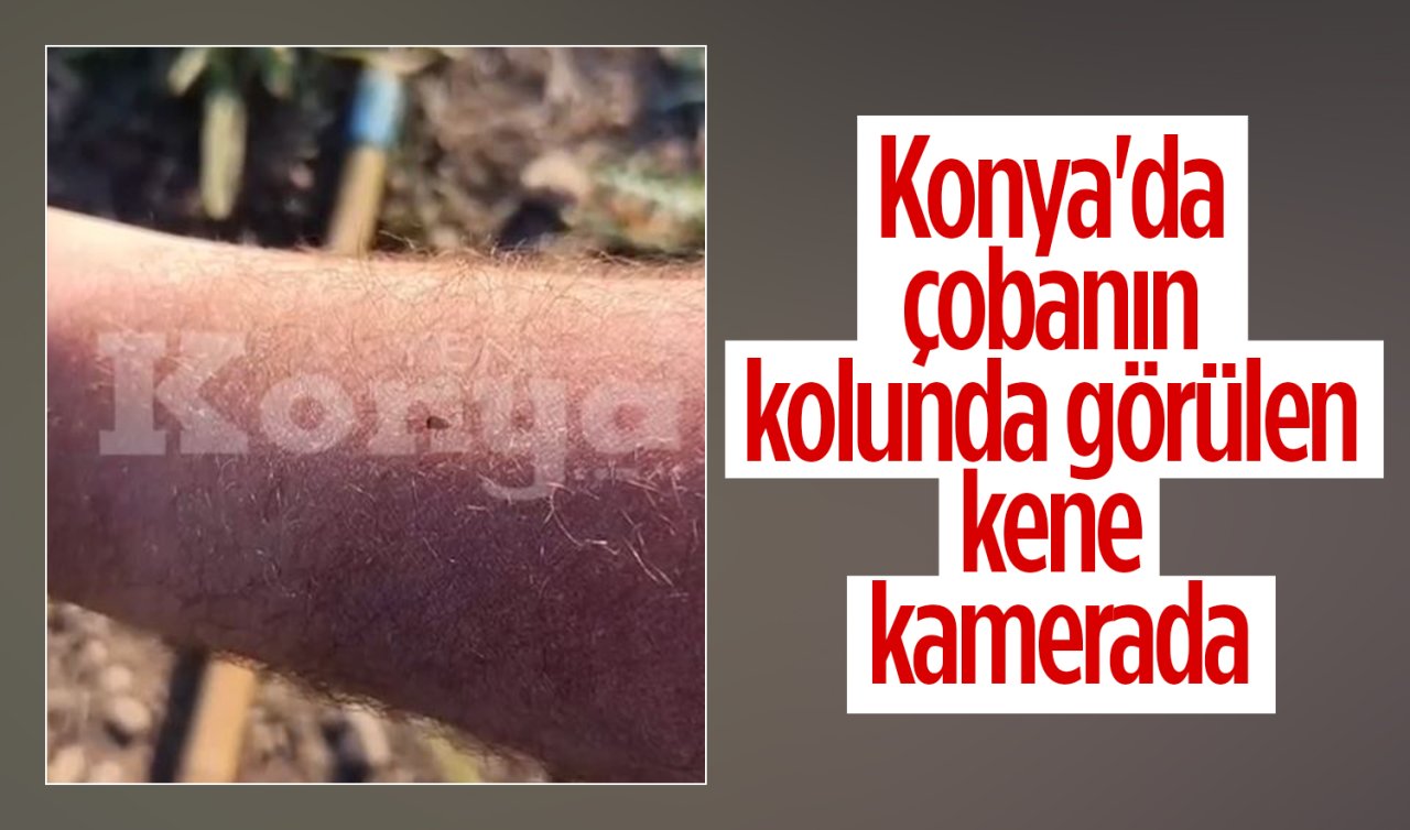 Konya’da çobanın kolunda görülen kene kamerada