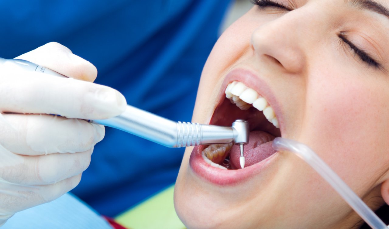  Diş implantı nedir ve nasıl uygulanır?
