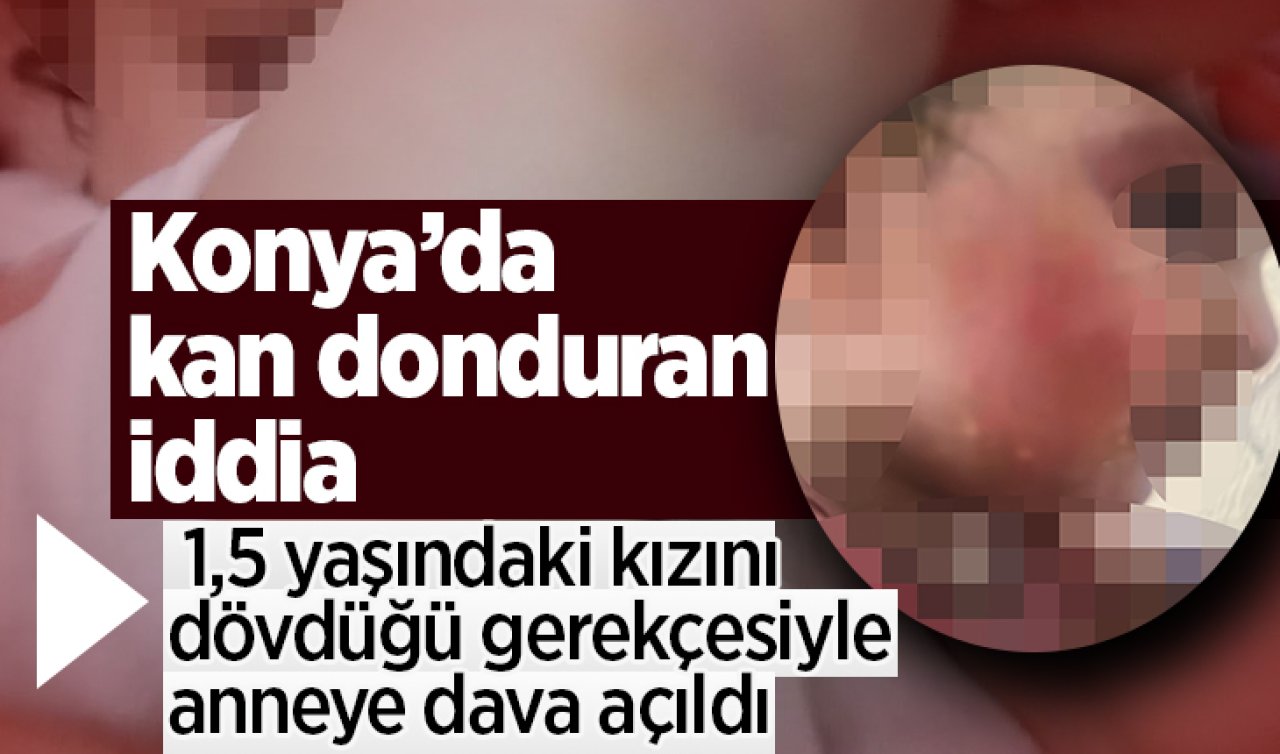 Konya’da kan donduran iddia: 1,5 yaşındaki kızını dövdüğü gerekçesiyle anneye dava açıldı