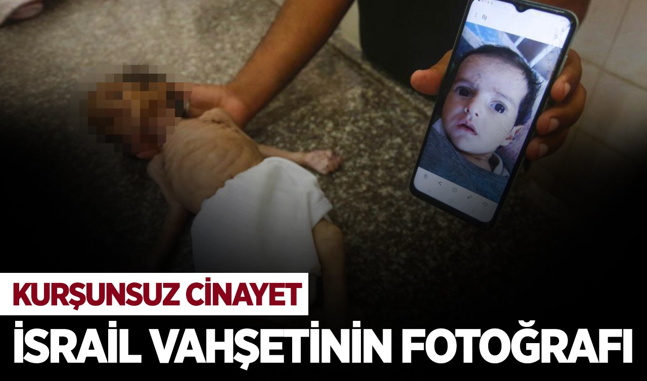 İsrail ablukası altındaki Gazze’de 3 aylık bebek Curi de açlıktan öldü