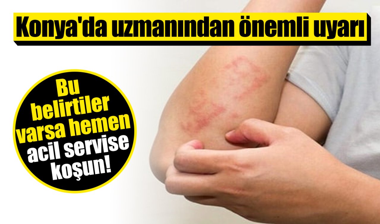 Konya’da uzmanından uyarı: Bu belirtiler varsa hemen acil servise başvurulmalı