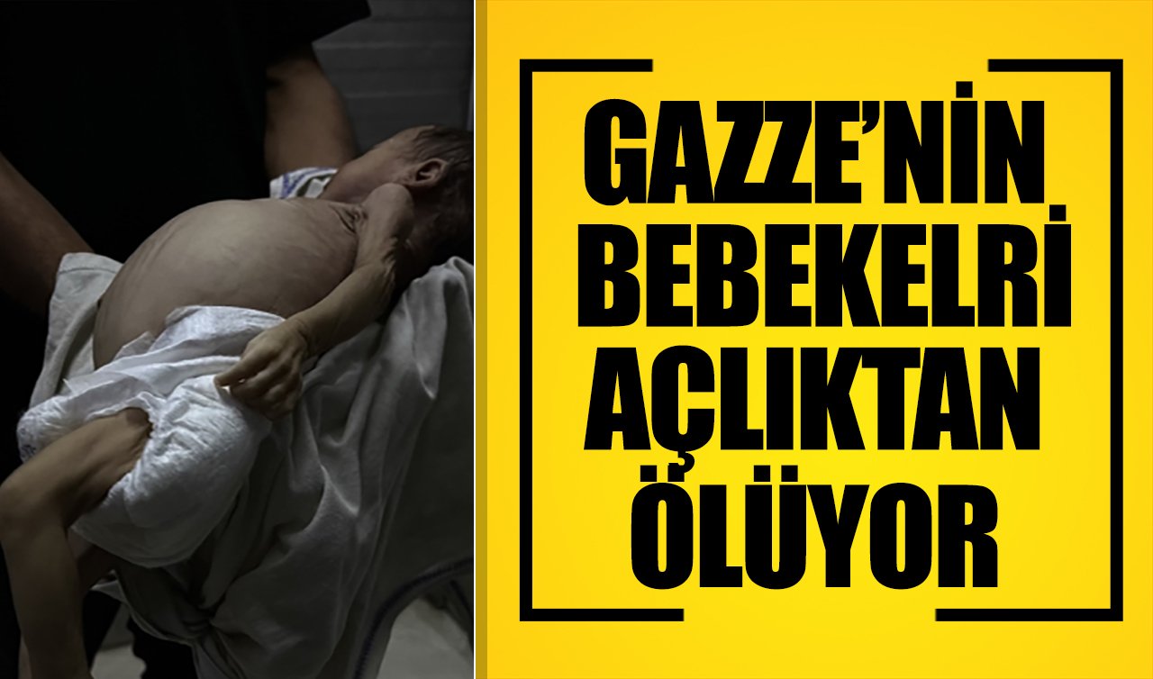 Gazze’nin bebekleri açlıktan ölüyor