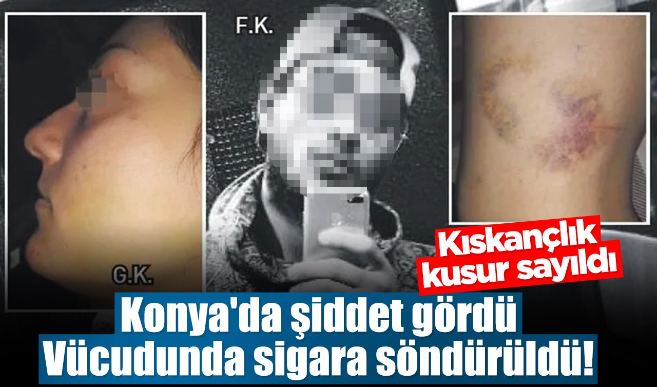 Konya’da şiddet gördü: Vücudunda sigara söndürüldü! Kıskançlık kusur sayıldı