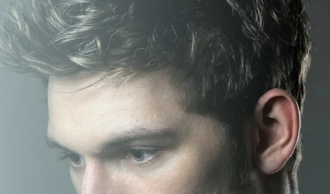  Türkiye’de Saç Ekim Troy Hair