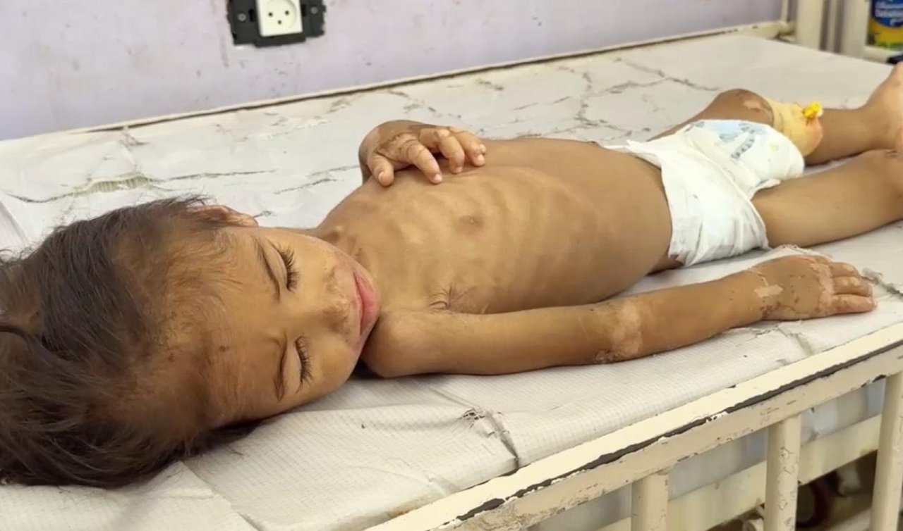 Gazze’de son 24 saatte 1’i çocuk 3 kişi daha açlıktan hayatını kaybetti