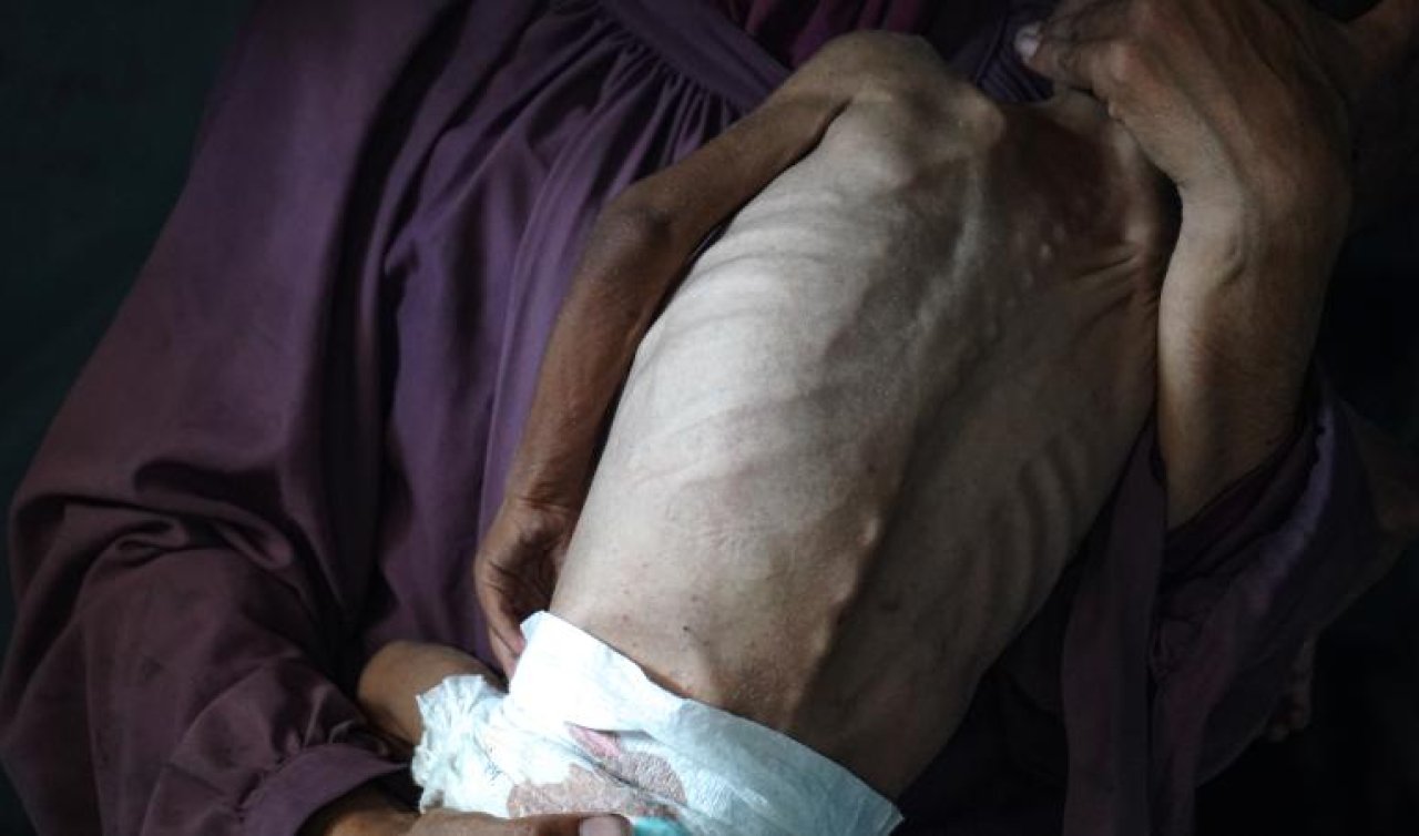 Katil İsrail’in kıtlığı dayattığı Gazze’de son 24 saatte 5 kişi daha açlıktan hayatını kaybetti