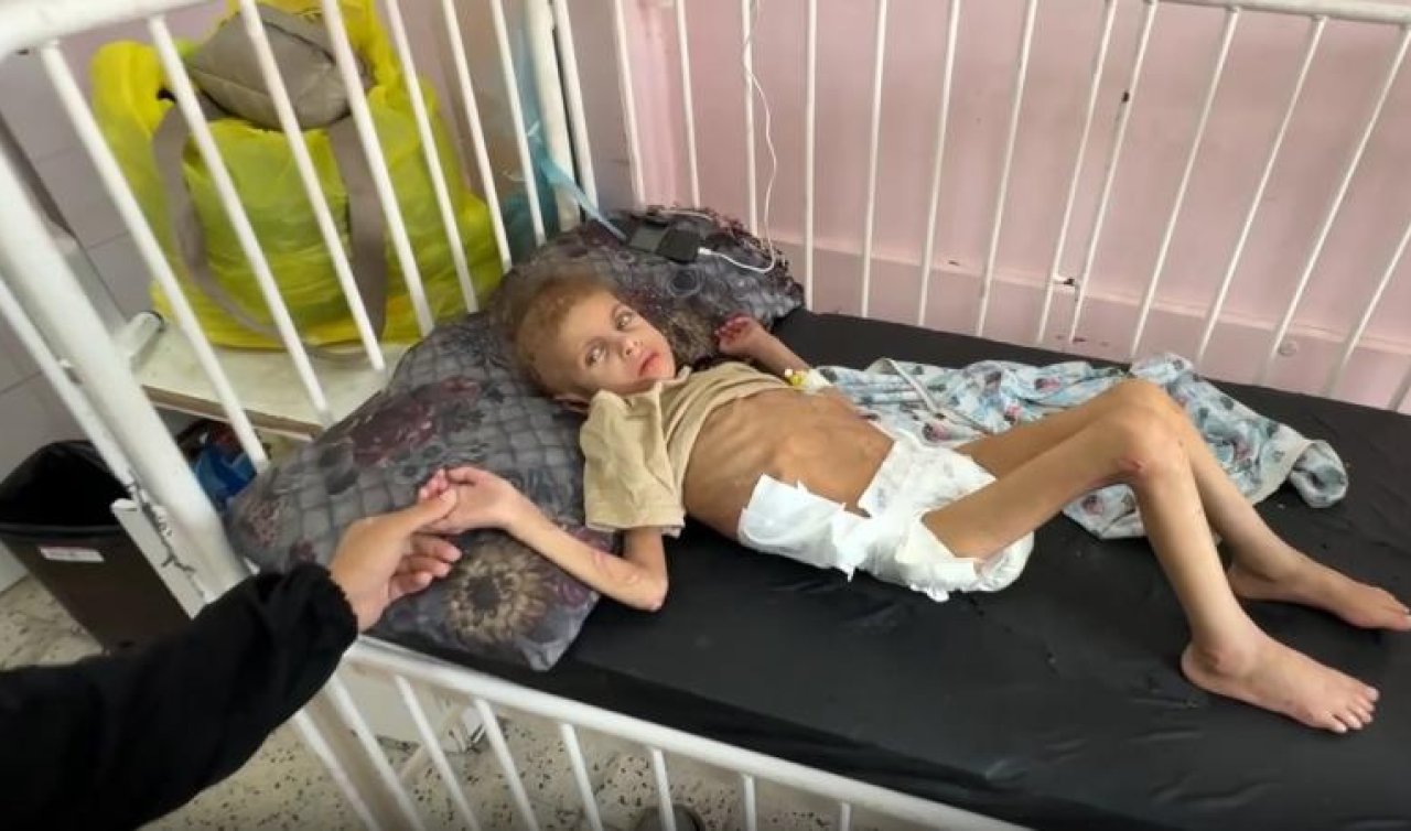 Gazze’de 12 kiloya düşen 7 yaşındaki May yürüme yetisini kaybetti
