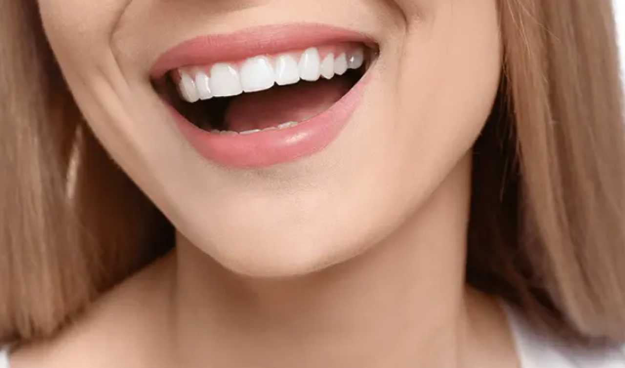 Hollywood Smile, Emax Kaplama ve Gülüş Tasarımı: Mükemmel Gülüşe Giden Yol