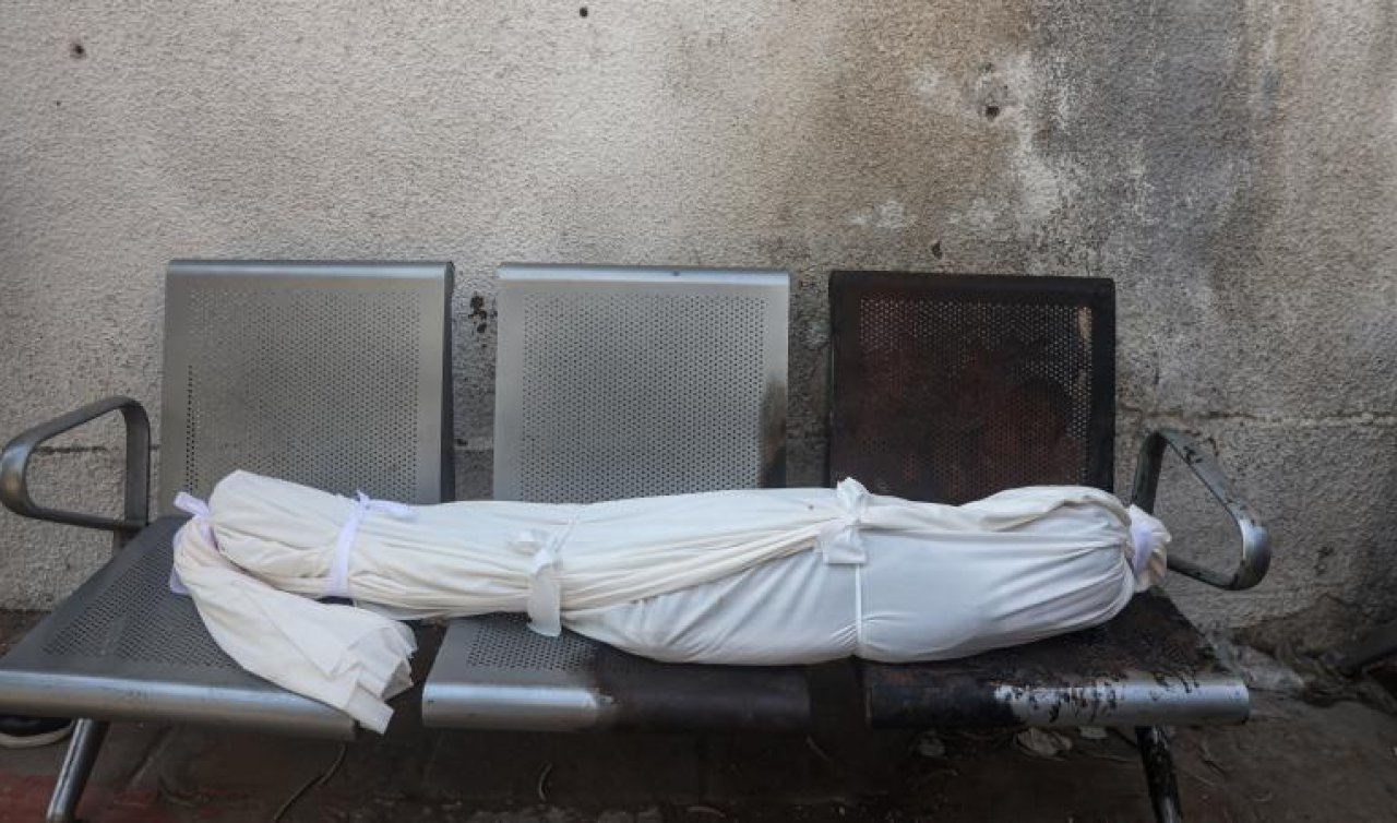 Katil İsrail’in Gazze’ye saldırılarının etkisi sürüyor: Son 24 saatte 44 artarak 67 bin 913’e çıktı!