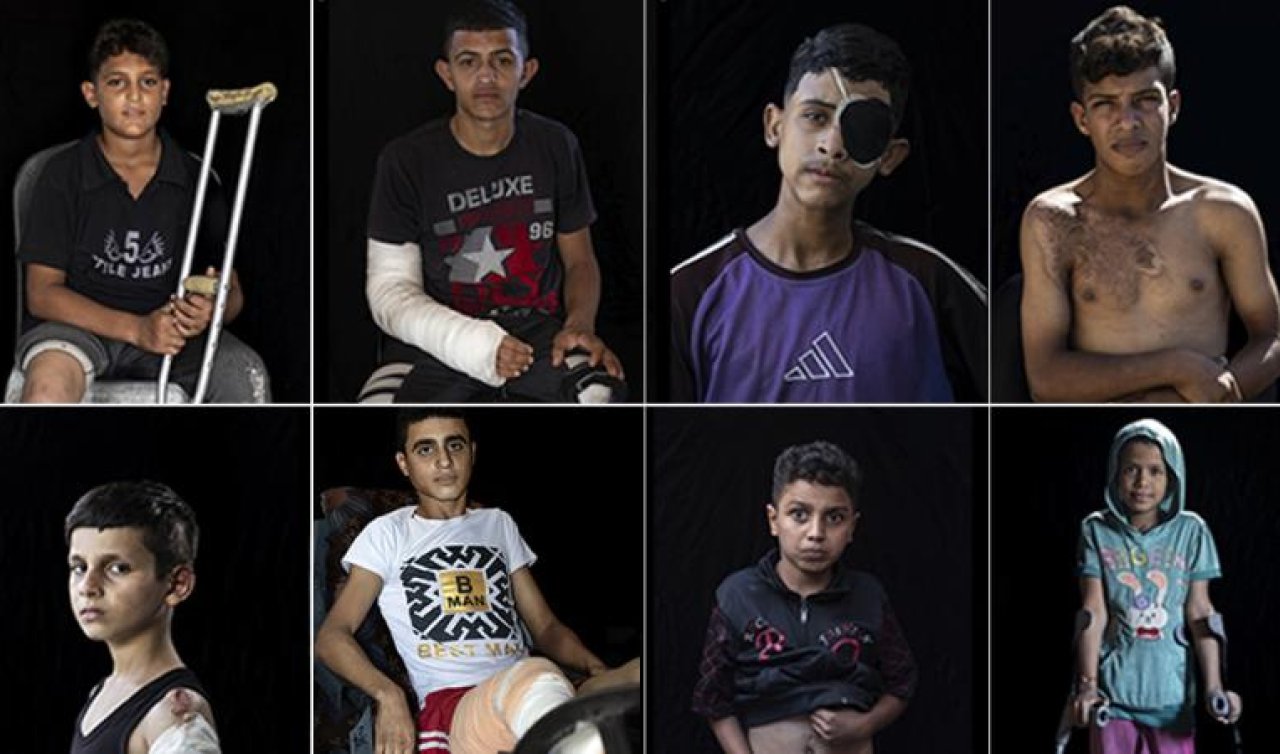 Gazze’de 5 bini aşkın çocuk ampute edildi