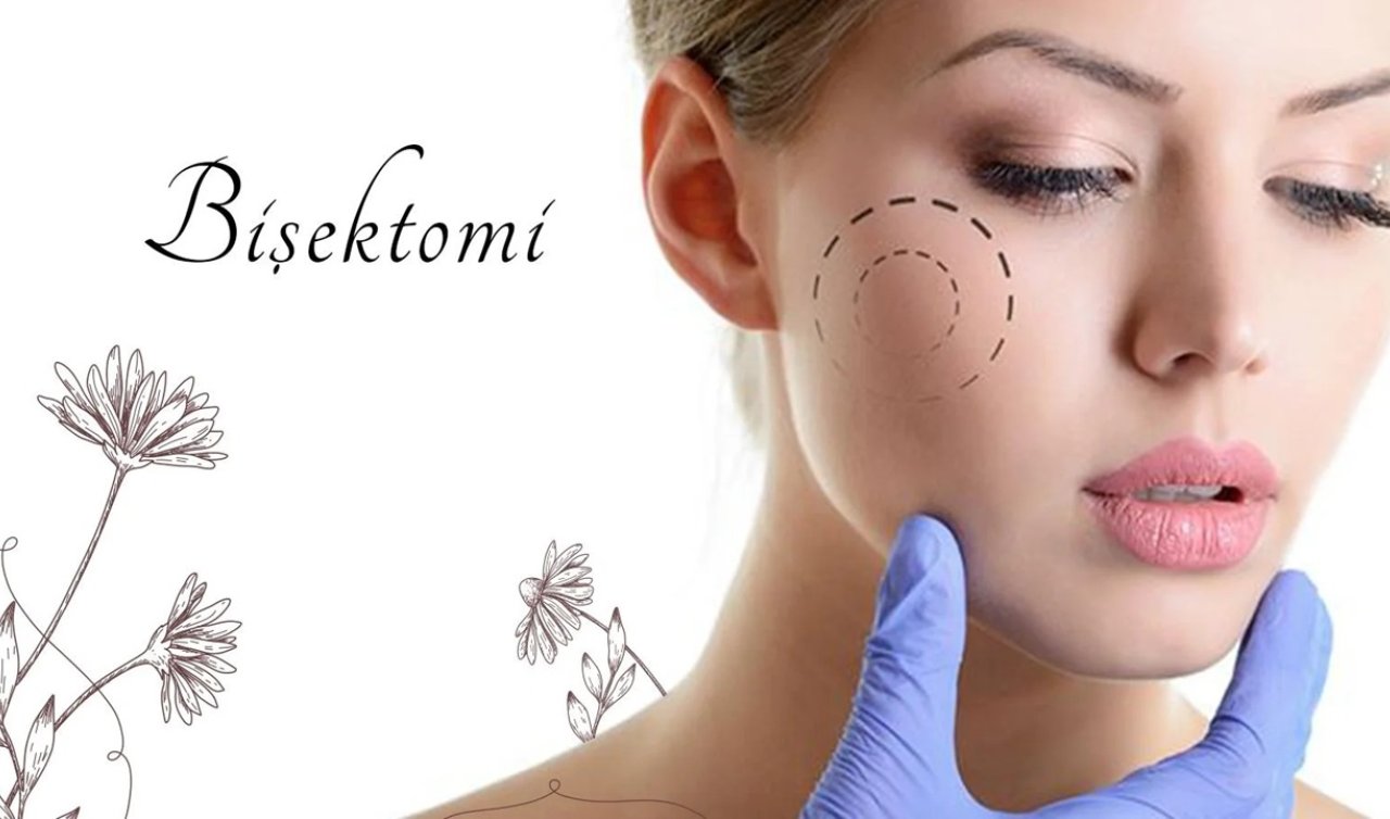  Bişektomi ile Çok Daha Belirgin Yüz Hatları