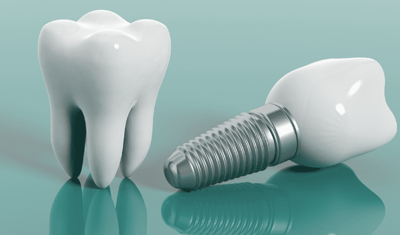  Sağlıklı Bir Gülüş İçin İzmir’de Profesyonel Diş Tedavileri