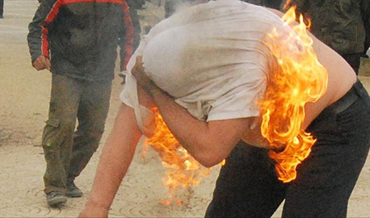  Belediye önünde kendini yaktı