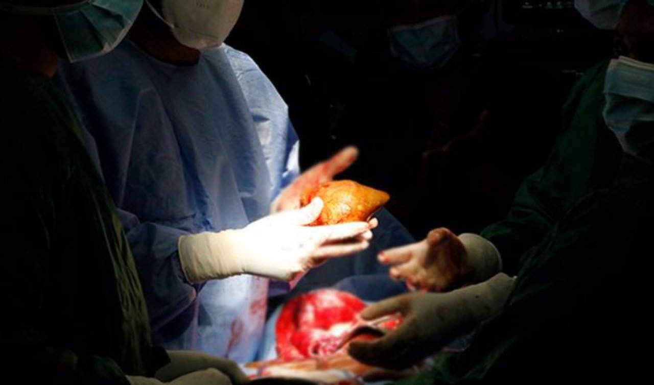 Kuduzlu böbrek nakli yapıldı hayatını kaybetti