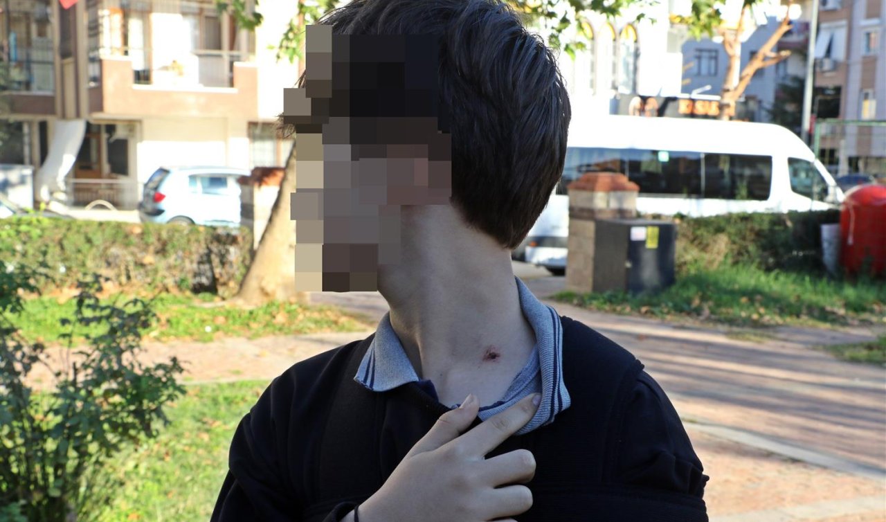 7’nci sınıf öğrencisine akran zorbalığı: Boynunu mermere çarptı! 