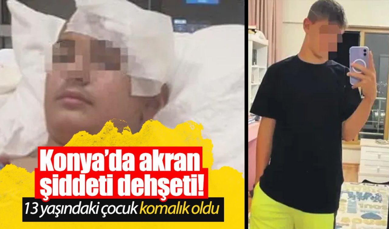 Konya’da akran şiddeti dehşeti! 13 yaşındaki çocuk komalık oldu