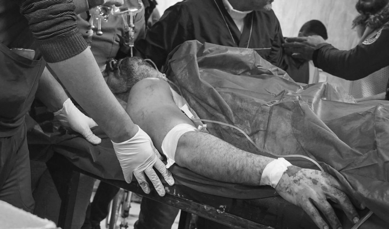 Terör örgütü YPG’nin Halep’teki saldırılarında 7 kişi öldü 52 kişi yaralandı