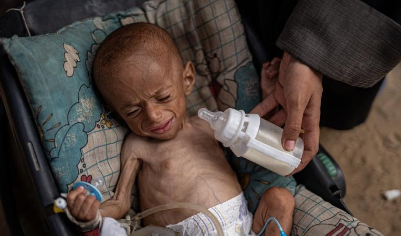 DSÖ: Gazze’de 4 bini çocuk 18 bin 500’den fazla hasta tıbbı tahliyeye ihtiyaç duyuyor